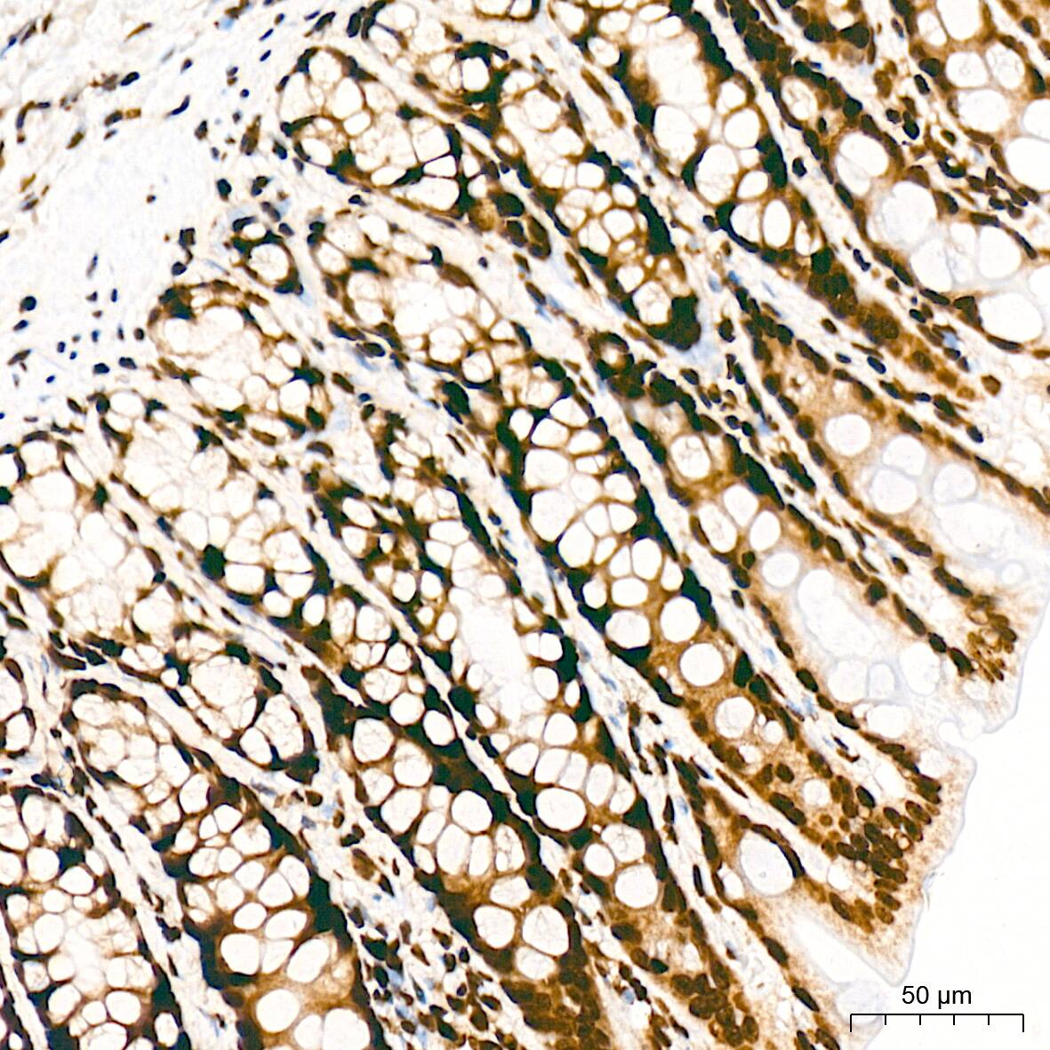 Histone H3 [ac Lys27] Antibody (2V10N10)