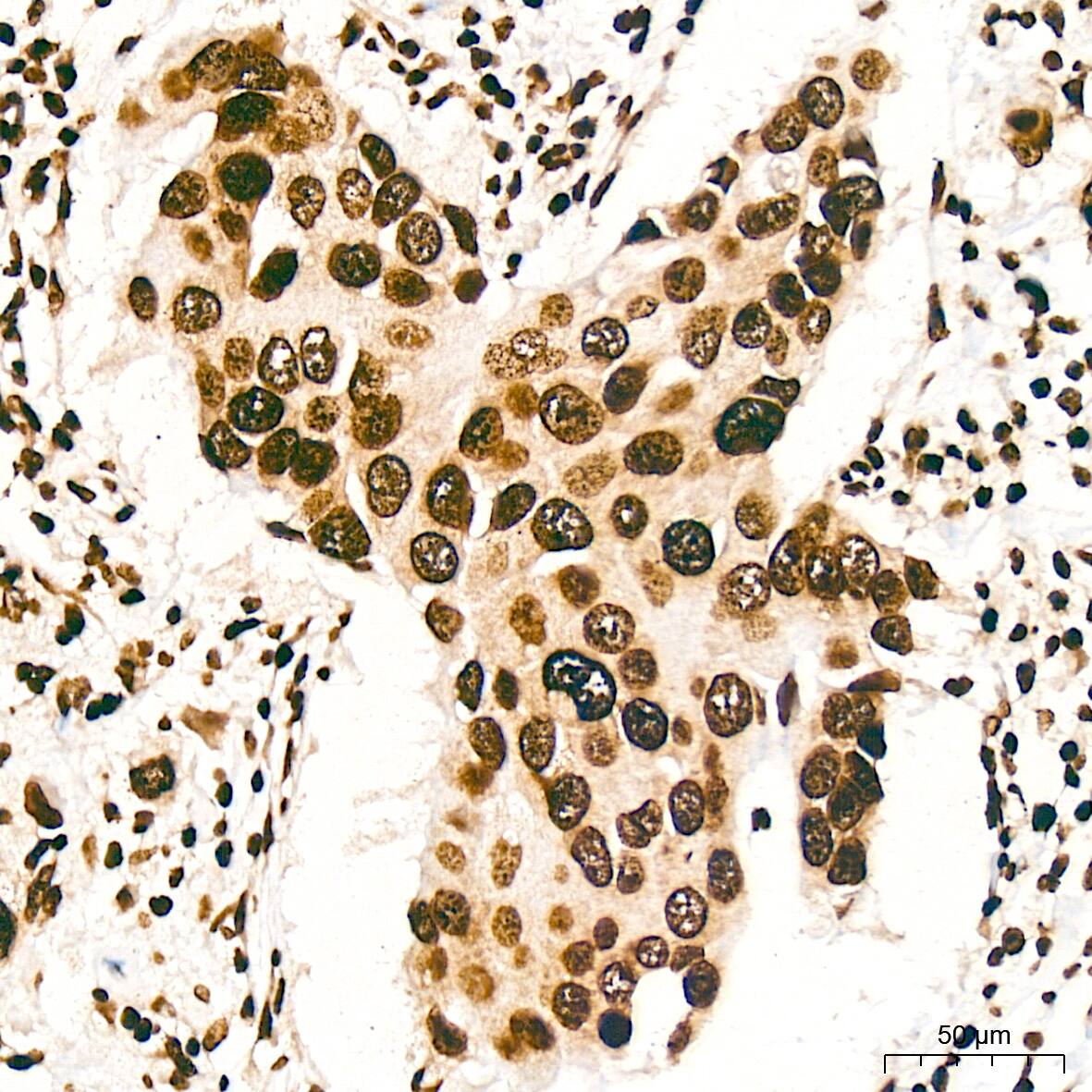 Histone H3 [ac Lys27] Antibody (2V10N10)