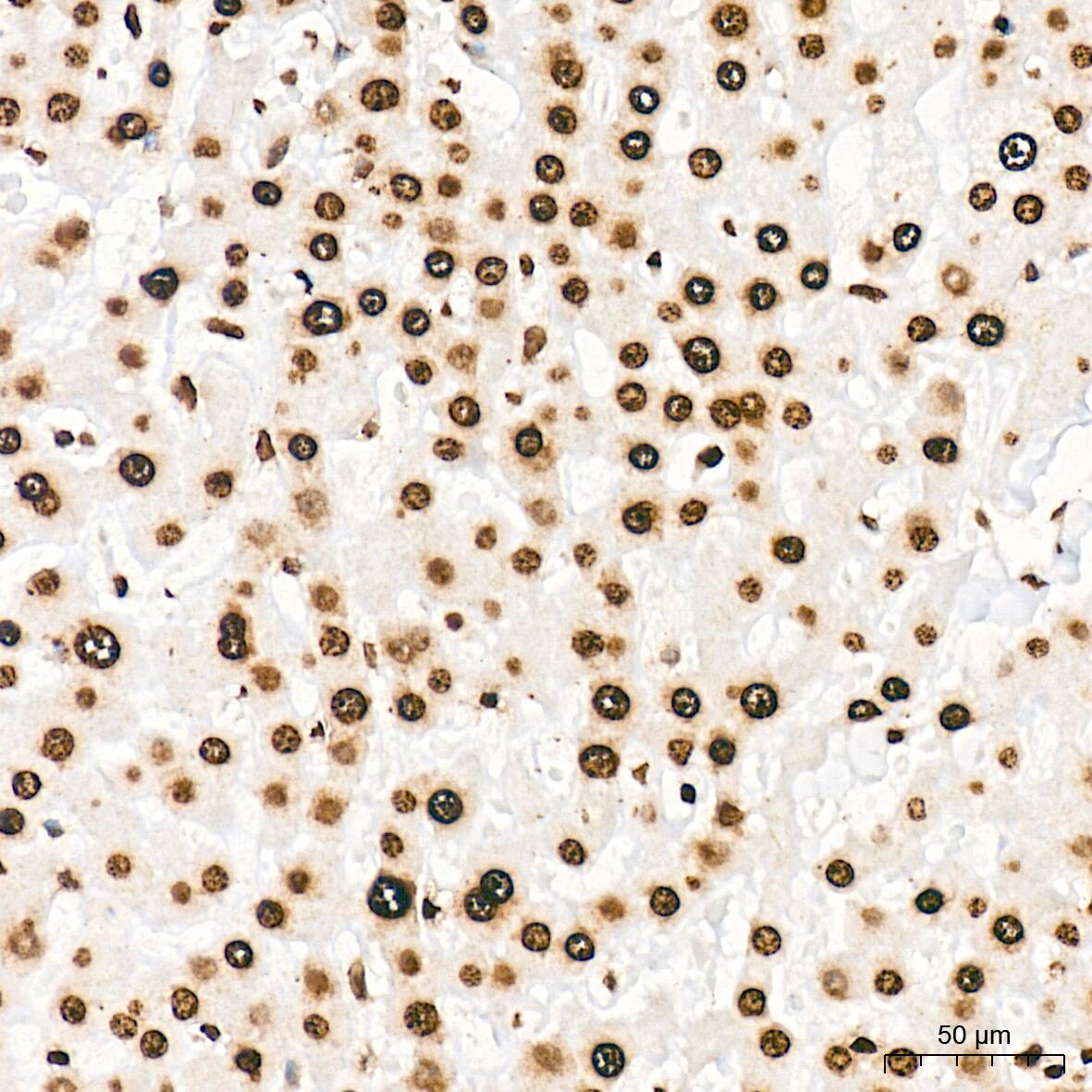 Histone H3 [ac Lys27] Antibody (2V10N10)