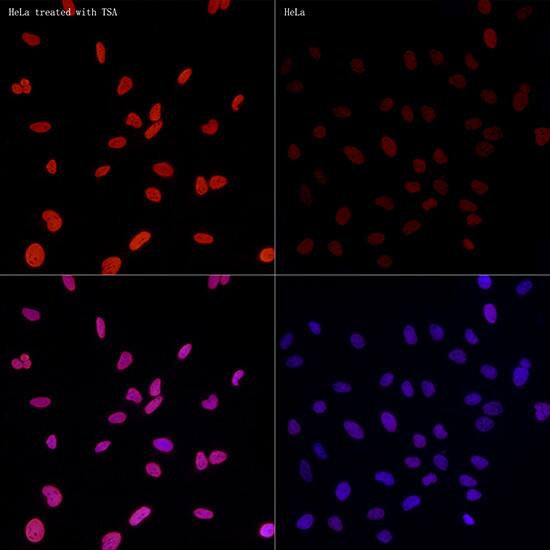 Histone H3 [ac Lys27] Antibody (2V10N10)