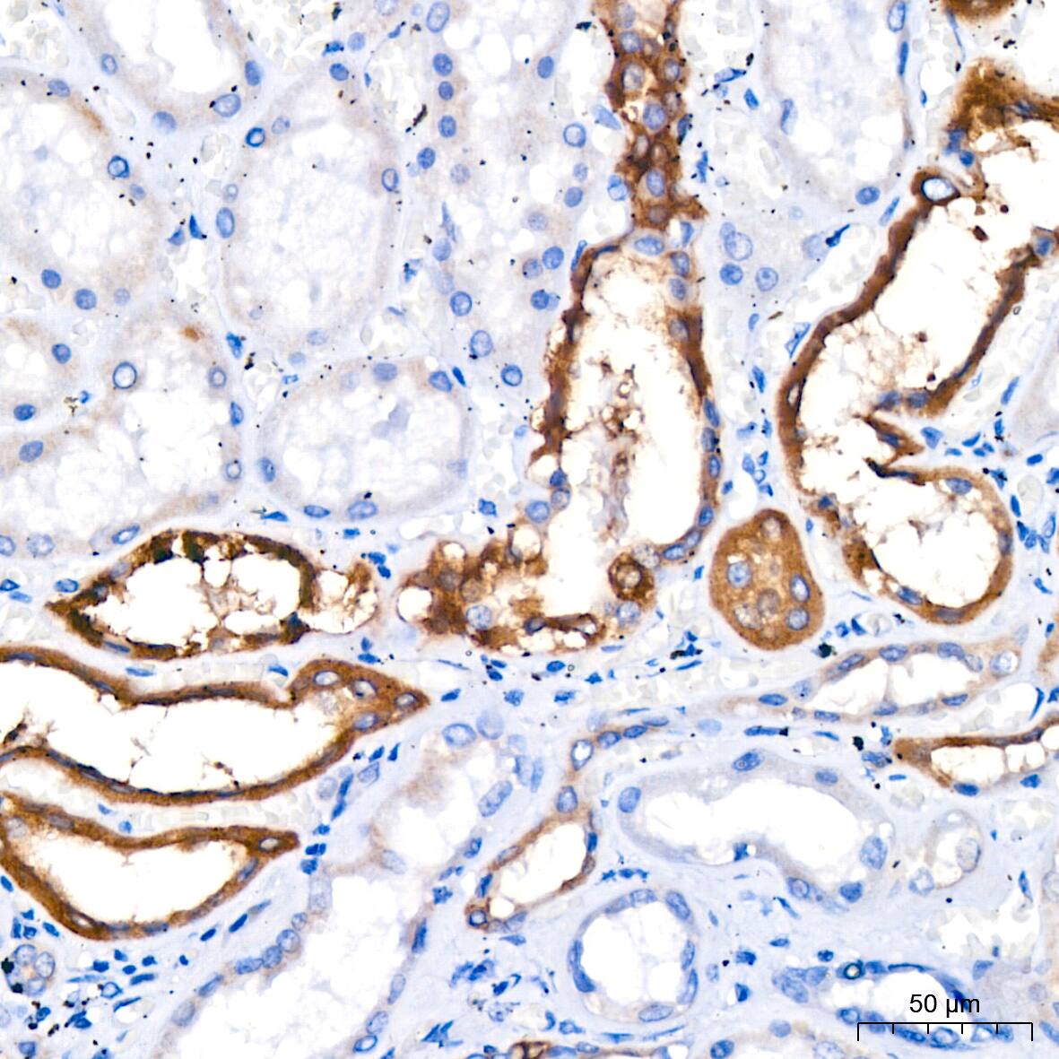 FACL4 Antibody (4W3T9)