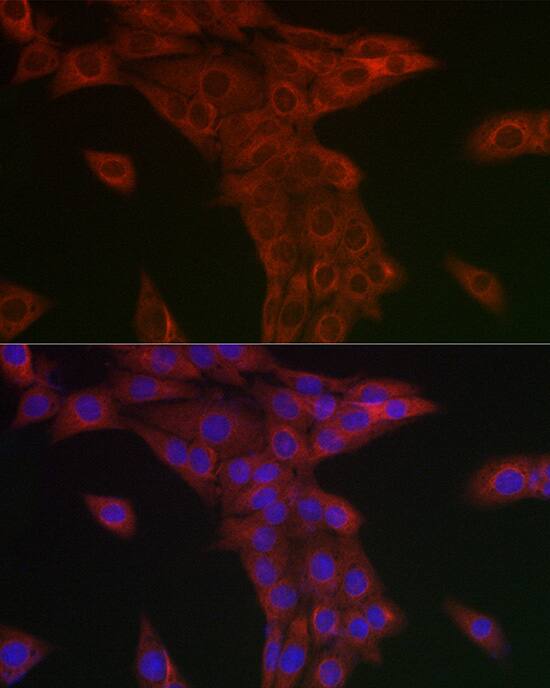 Syntrophin alpha 1 Antibody - Azide and BSA Free