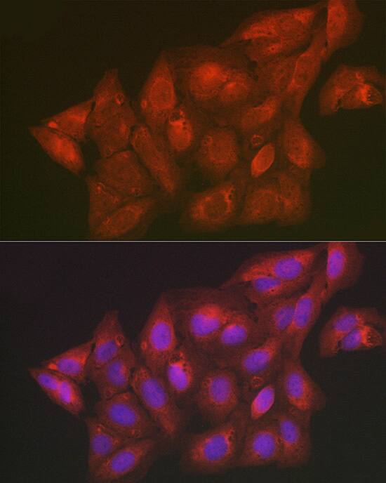 Secernin-1 Antibody - Azide and BSA Free