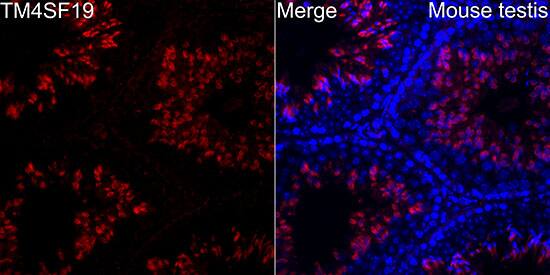TM4SF19 Antibody - Azide and BSA Free