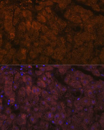 ADAMTS13 Antibody (7B2Z8)