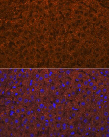 ADAMTS13 Antibody (7B2Z8)