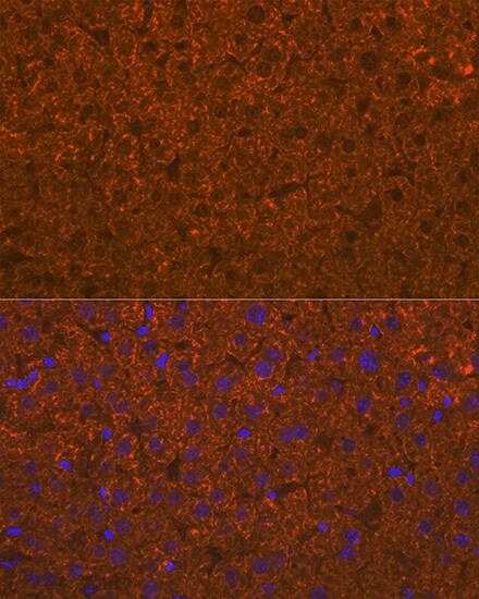 ADAMTS13 Antibody (7B2Z8)