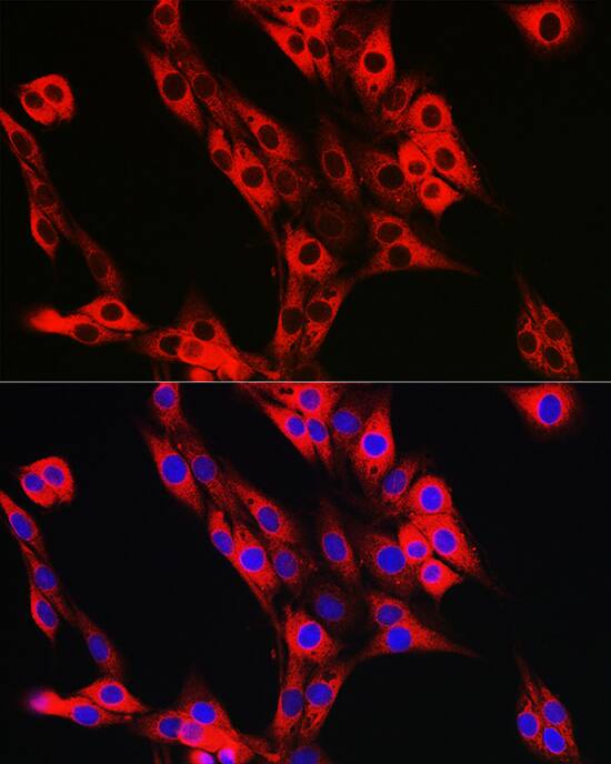 UFL1 Antibody - Azide and BSA Free