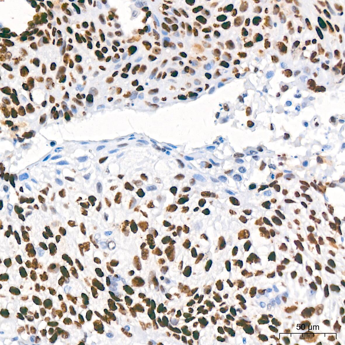 MCM2 Antibody (0Q10S9)