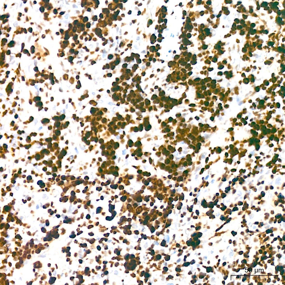 MCM2 Antibody (0Q10S9)