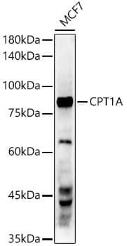 CPT1A Antibody (3M6E9)