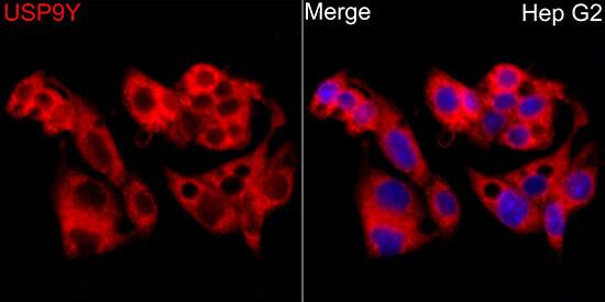 USP9Y Antibody - Azide and BSA Free
