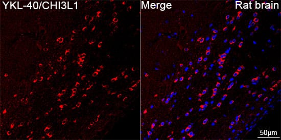 Chitinase 3-like 1/YKL-40 Antibody (7T1R3)