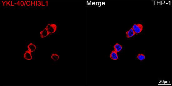 Chitinase 3-like 1/YKL-40 Antibody (7T1R3)