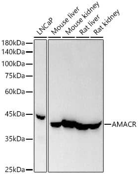 alpha-Methylacyl-CoA Racemase/AMACR Antibody (4R3L10)