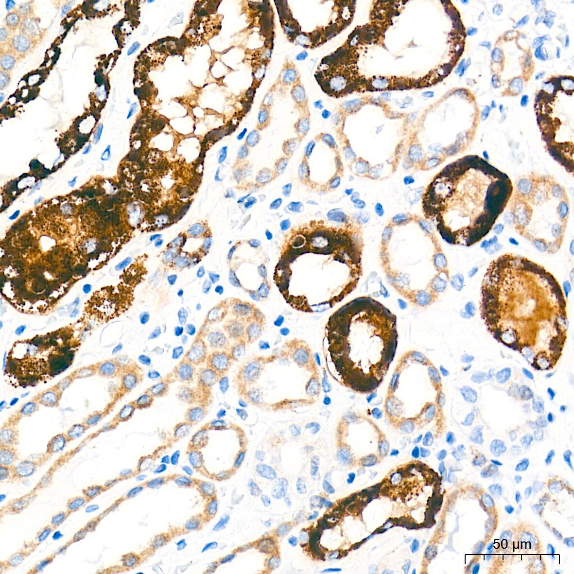 alpha-Methylacyl-CoA Racemase/AMACR Antibody (7X5Z2)