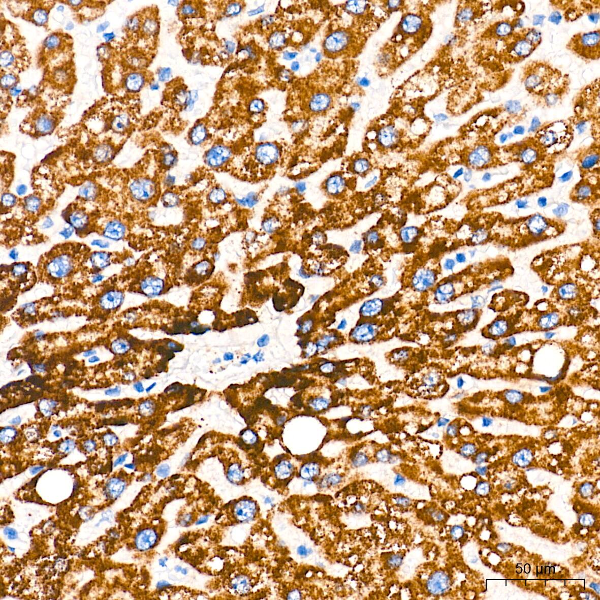 alpha-Methylacyl-CoA Racemase/AMACR Antibody (7X5Z2)