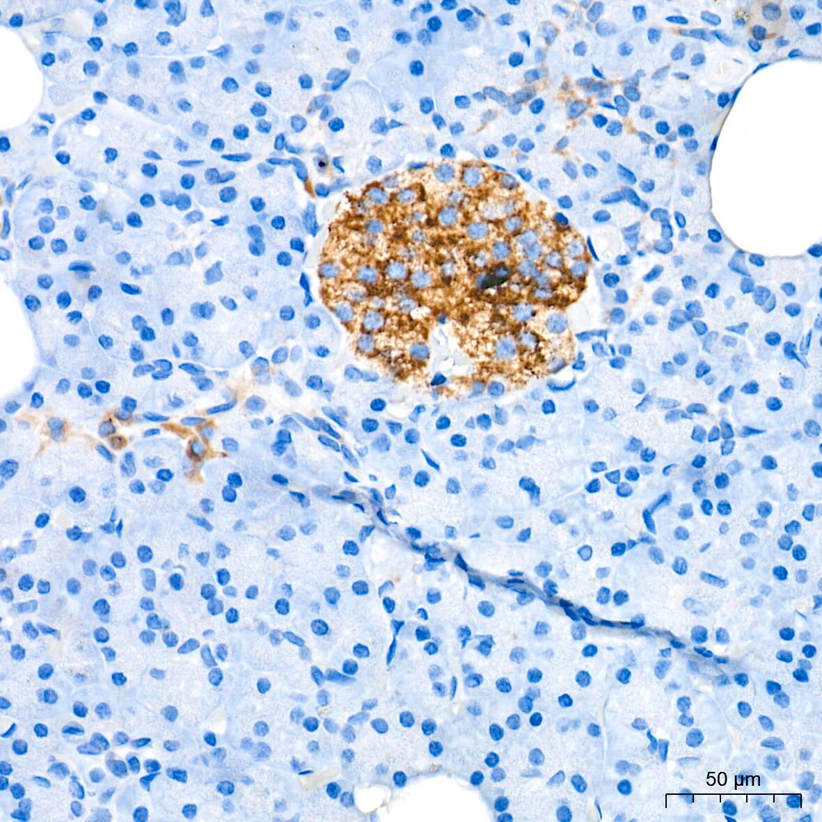 alpha-Methylacyl-CoA Racemase/AMACR Antibody (7X5Z2)