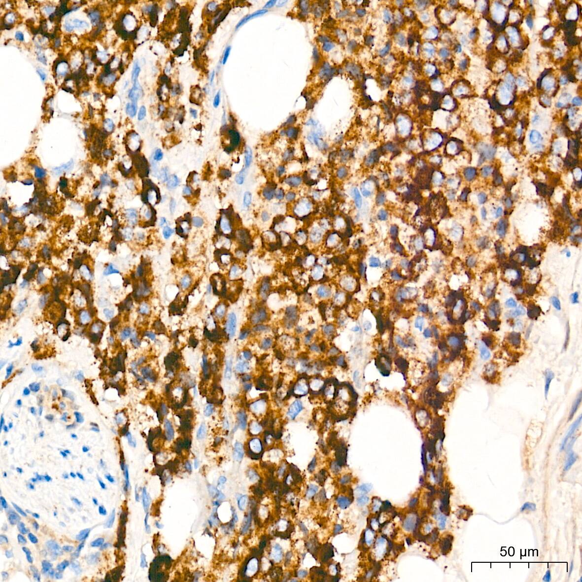 alpha-Methylacyl-CoA Racemase/AMACR Antibody (7X5Z2)
