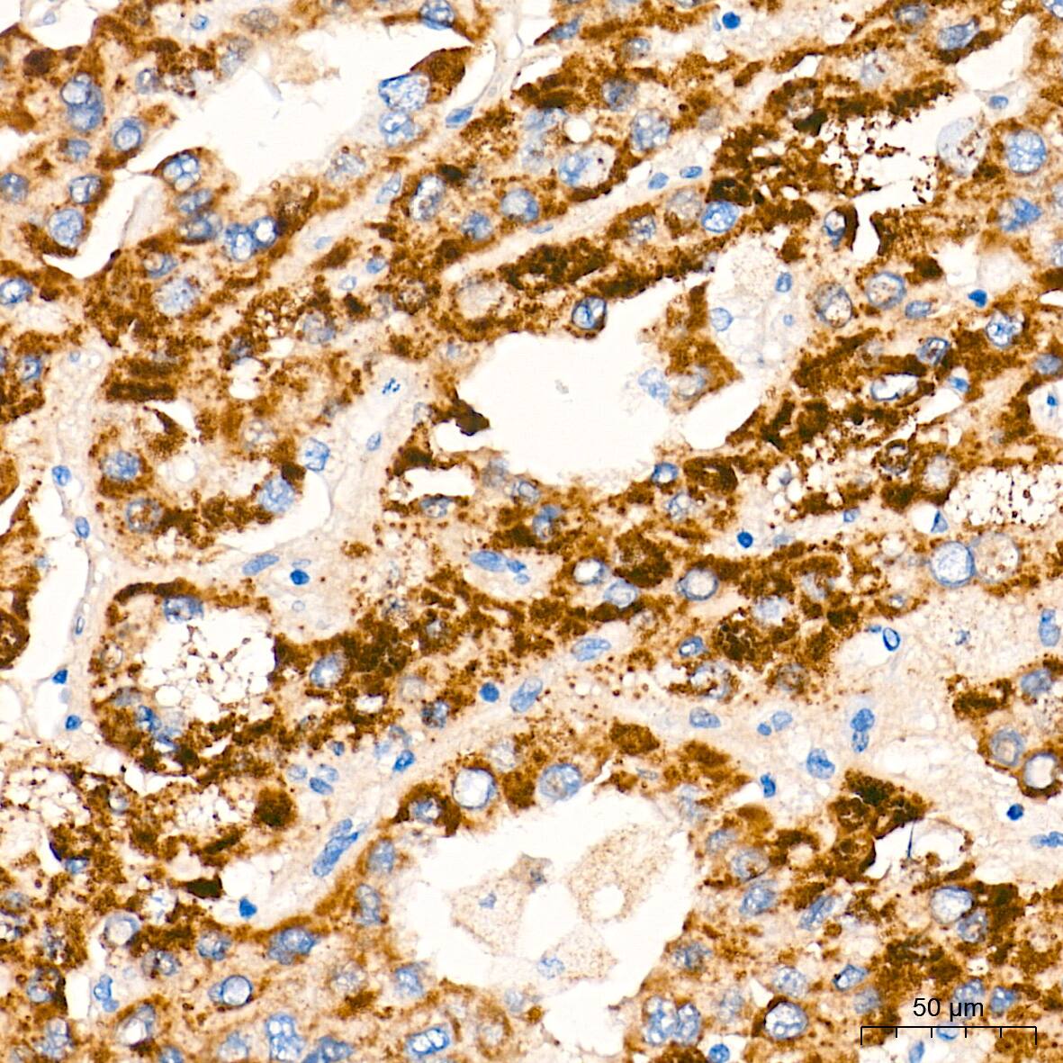 alpha-Methylacyl-CoA Racemase/AMACR Antibody (7X5Z2)