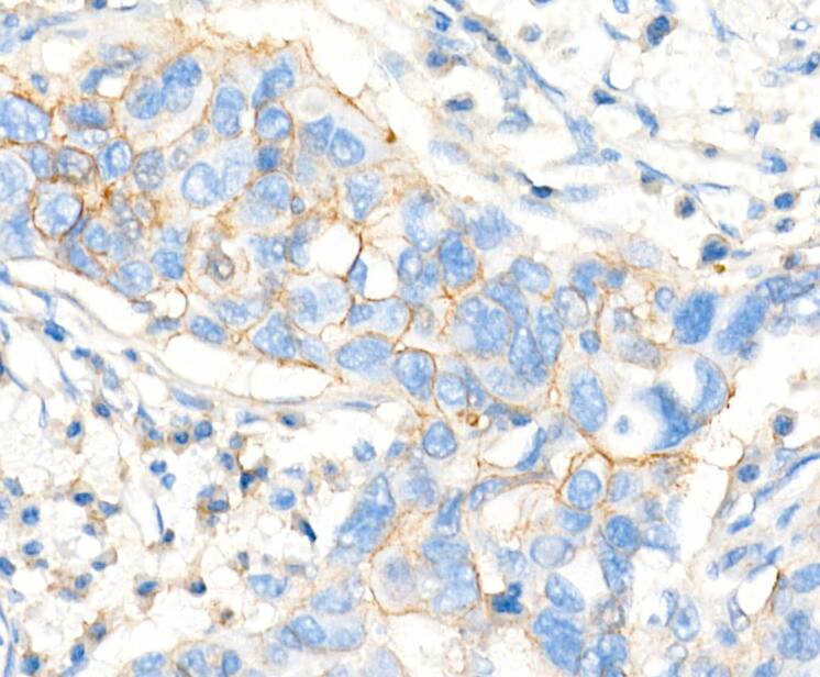 MRP1 Antibody (0J6M2)