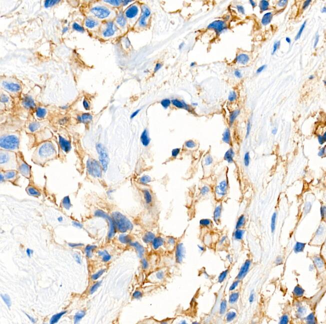 MRP1 Antibody (0J6M2)