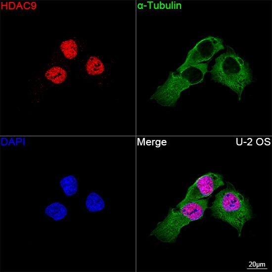 HDAC9 Antibody (3L5E5)