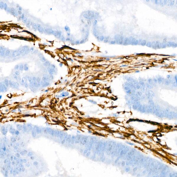 Actin Antibody (3U6B8)