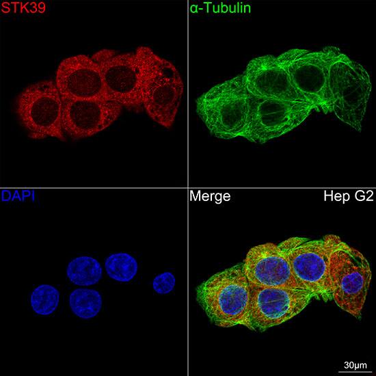 STK39 Antibody (0D9L5)