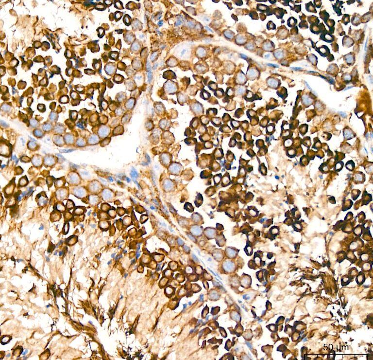 Activin RIB/ALK-4 Antibody (3U6I8)