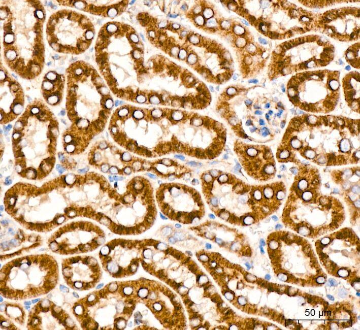 Activin RIB/ALK-4 Antibody (3U6I8)