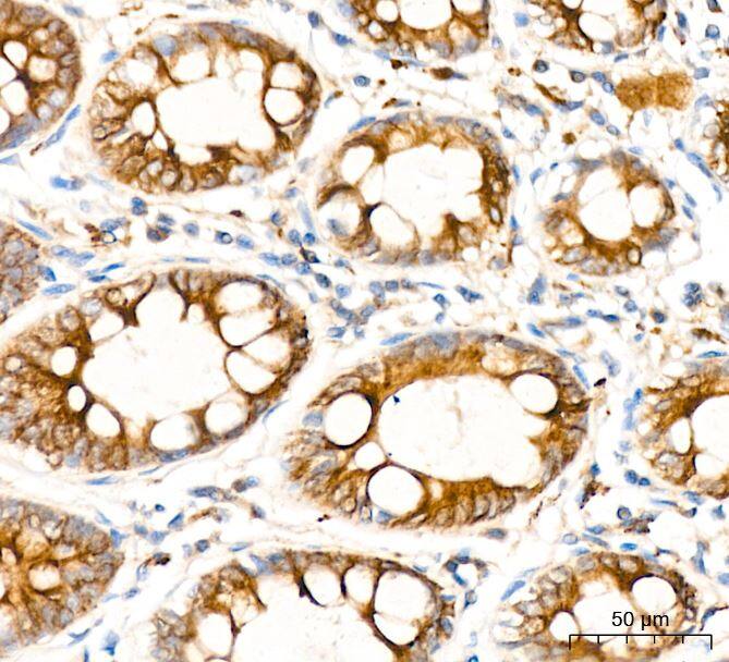Activin RIB/ALK-4 Antibody (3U6I8)