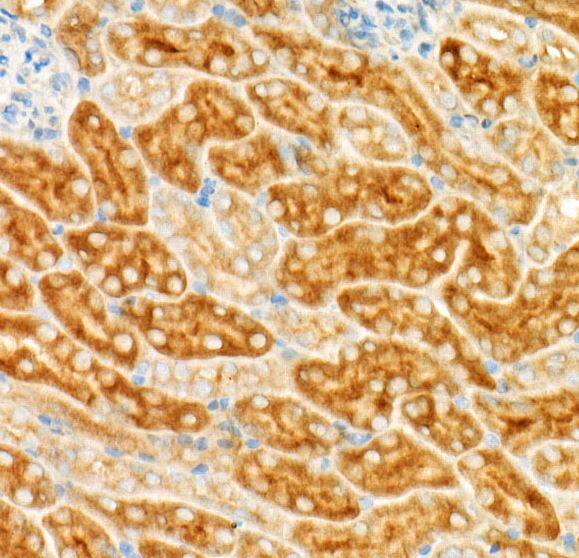 GCN2 Antibody (6E2X0)