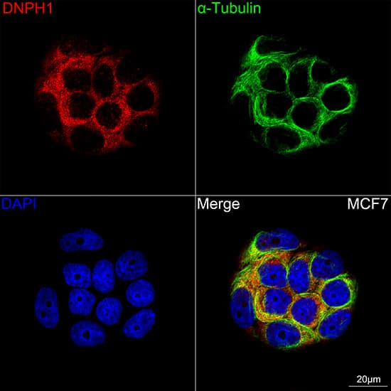 c-Myc-responsive protein Rcl Antibody (7C1Z8)