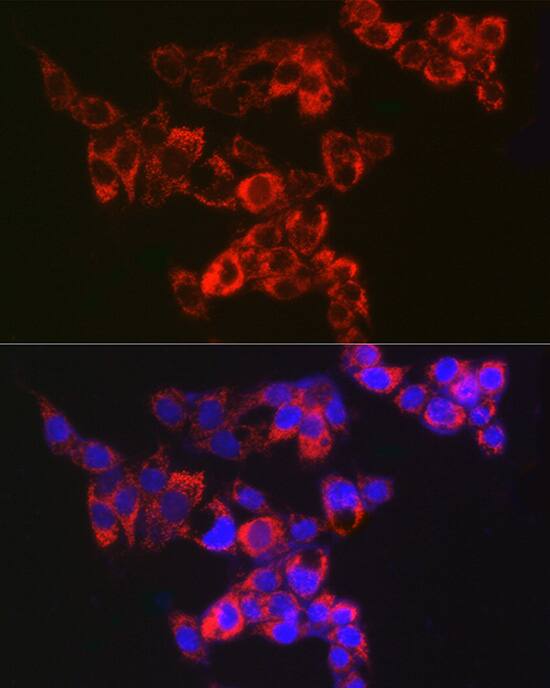 AK3L1 Antibody (9T5P1)
