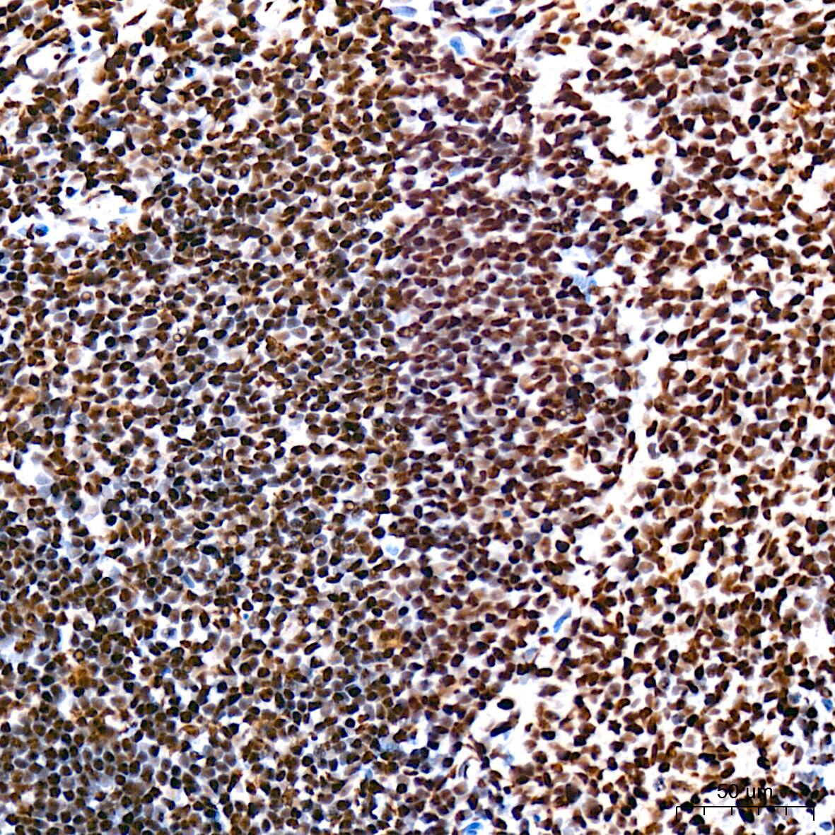 USP39 Antibody (1S9R9)