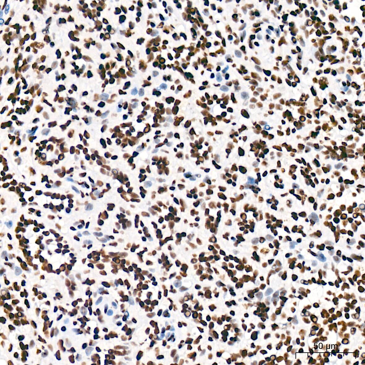 USP39 Antibody (1S9R9)