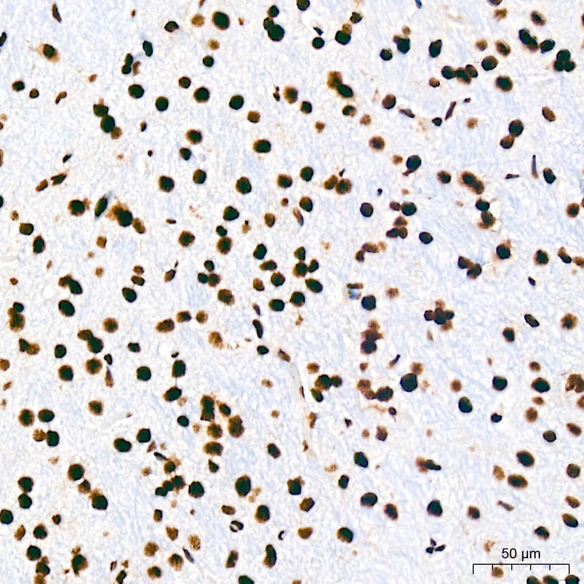 USP39 Antibody (1S9R9)