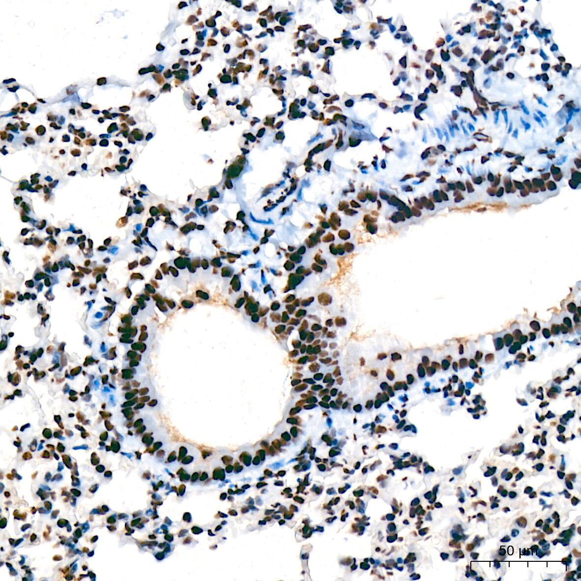 USP39 Antibody (1S9R9)