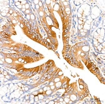 ROCK2 Antibody (8G3U2)