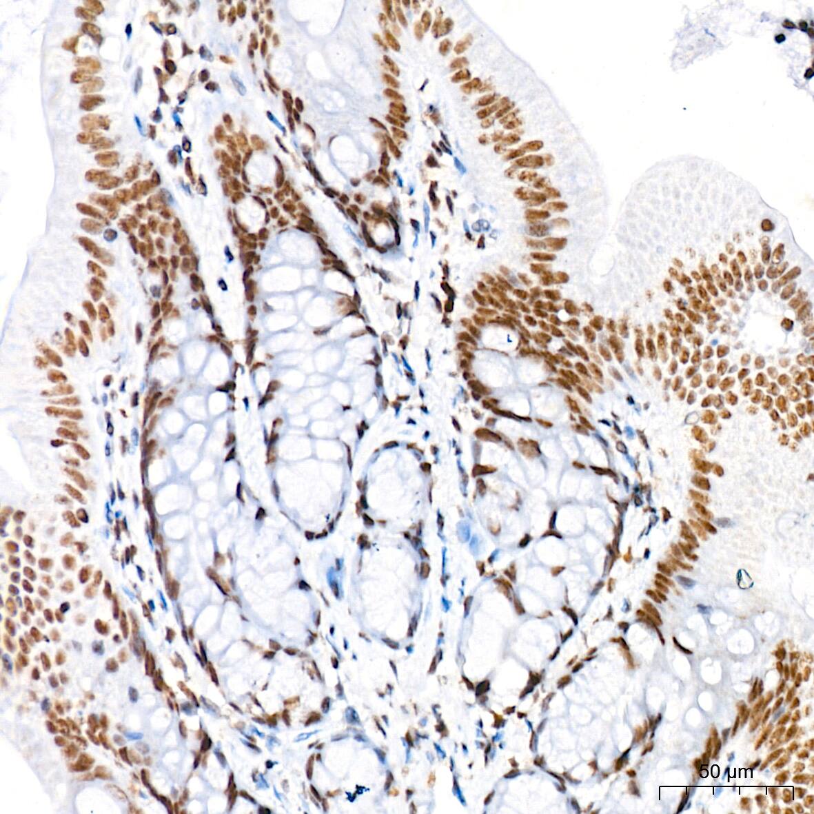SIN3A Antibody (8V5B6)