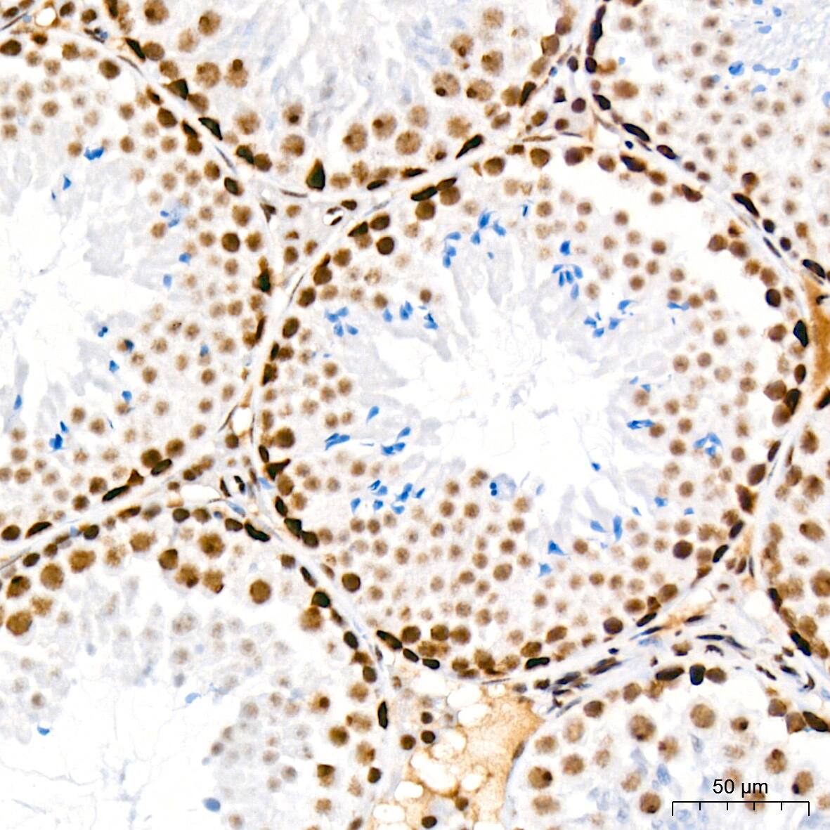 SIN3A Antibody (8V5B6)