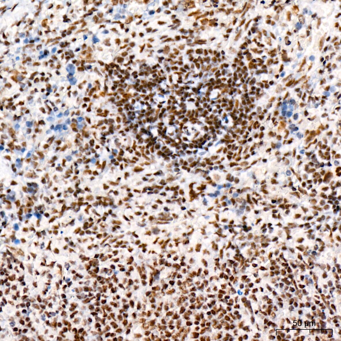 SIN3A Antibody (8V5B6)