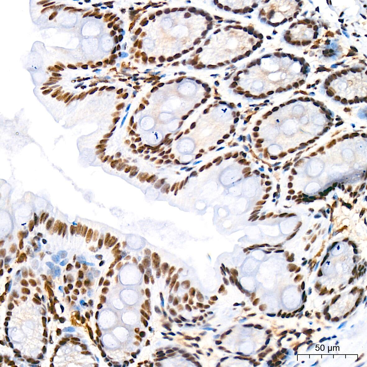 SIN3A Antibody (8V5B6)