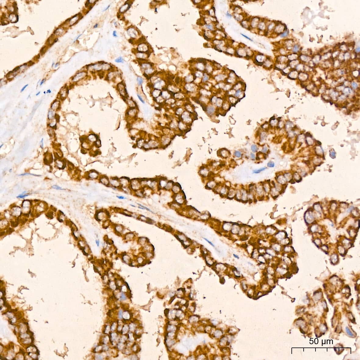 Peroxiredoxin 3 Antibody (4K7D1)