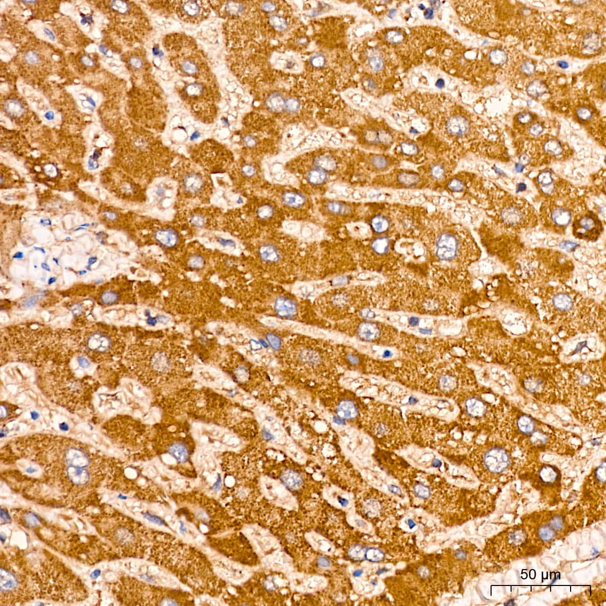 Peroxiredoxin 3 Antibody (4K7D1)