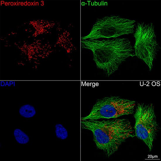 Peroxiredoxin 3 Antibody (4K7D1)