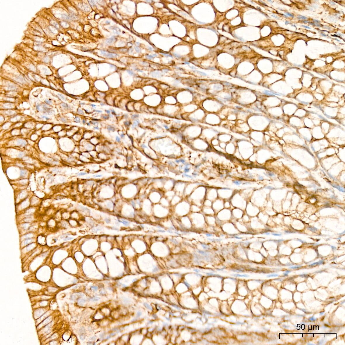 Alpha Fodrin Antibody (9H5V8)