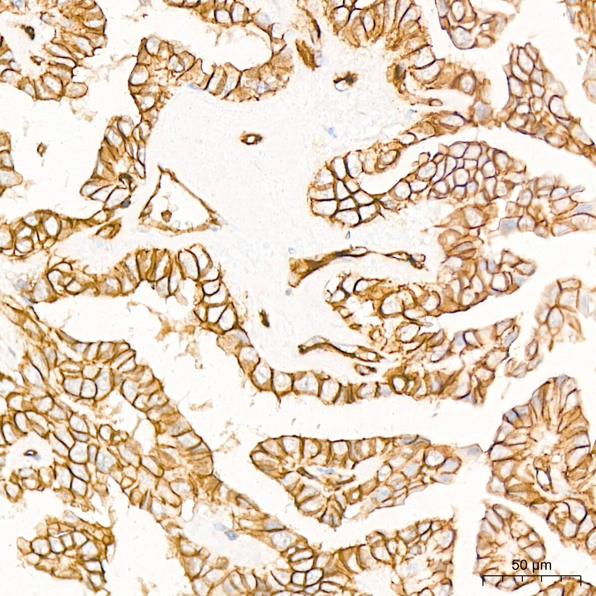 Alpha Fodrin Antibody (9H5V8)
