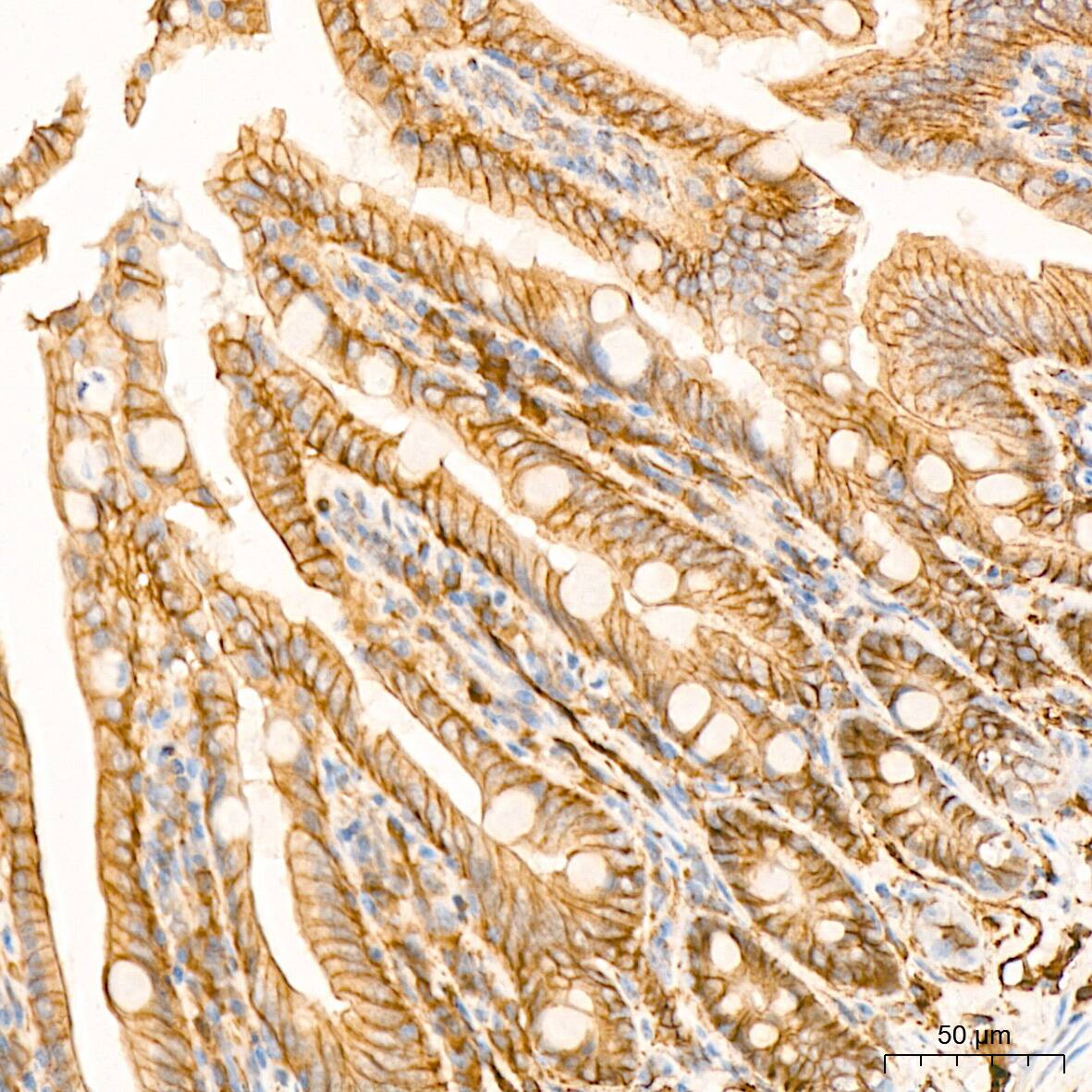Alpha Fodrin Antibody (9H5V8)